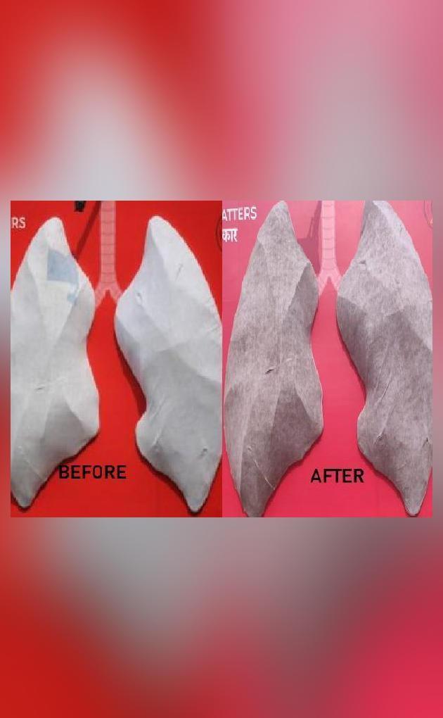 Artificial lungs outside Delhi hospital turn black in 48 hrs National