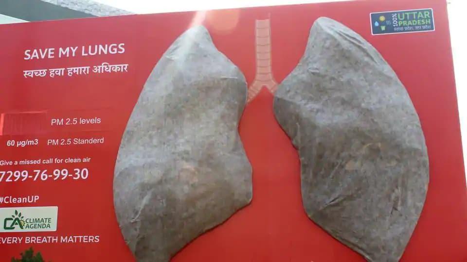 Artificial lungs turn black in 24hrs in Lucknow; Delhi took 6 days